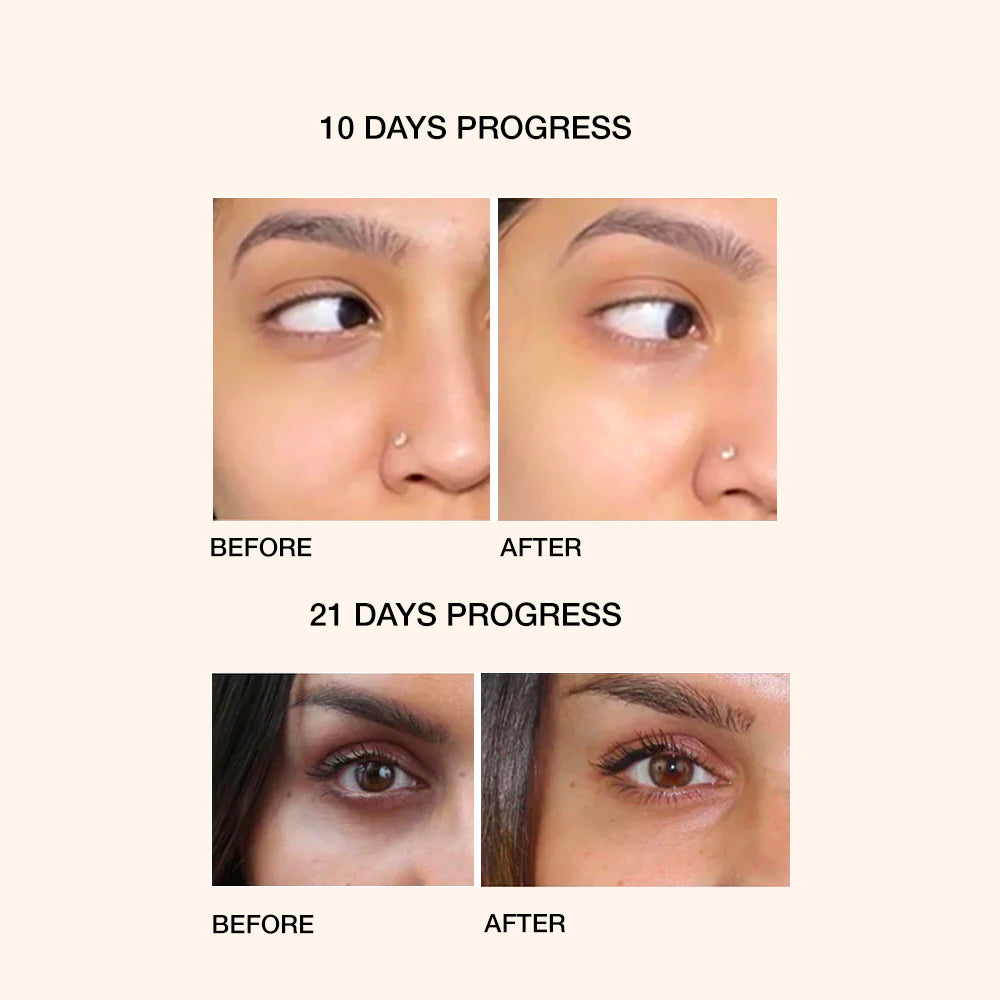 UNDER EYE REPAIR OIL