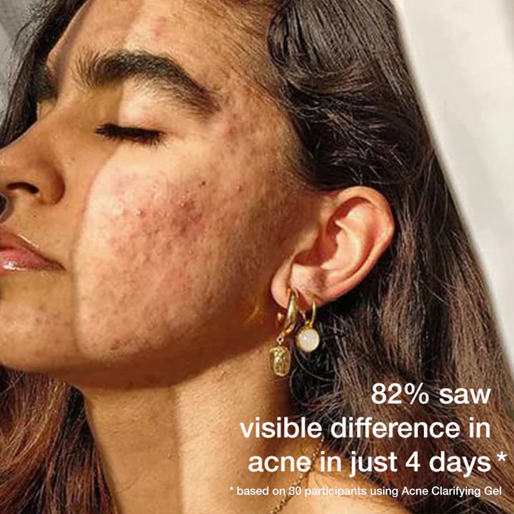 ACNE CLARIFYING GEL COMBO