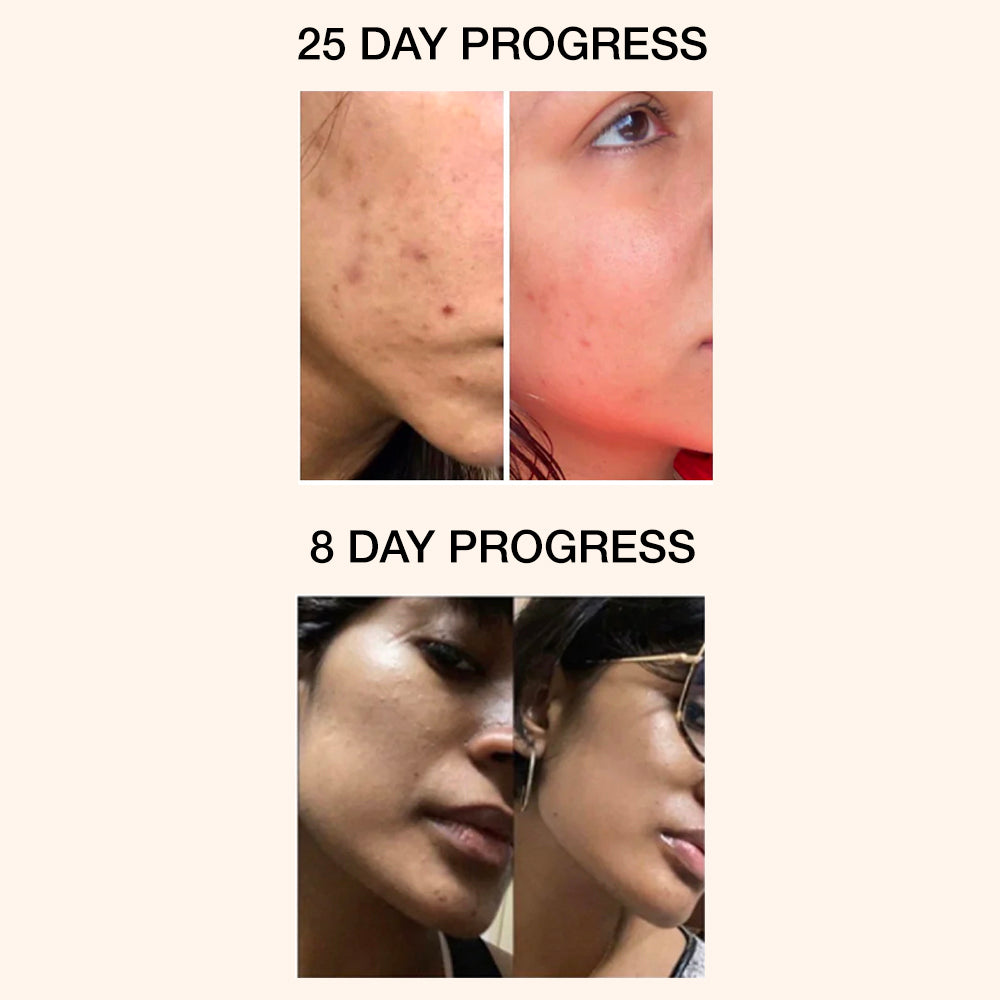 CLARIFYING & BRIGHTENING SERUM